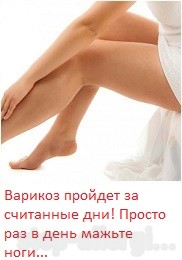 Дисгидротическая экзема - Как вылечить аллергию Дисгидротическая экзема - Как вылечить аллергию