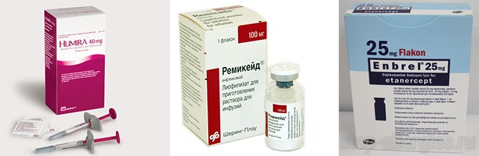 Псориаз сгибательных поверхностей - Как вылечить аллергию Псориаз сгибательных поверхностей - Как вылечить аллергию