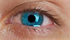 Аллергия насморк и болят глаза
